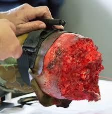 TrueClot Emergency Tourniquet Trainer-Tactical Source LLC